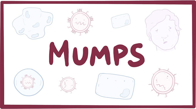 Harare reports mumps outbreak