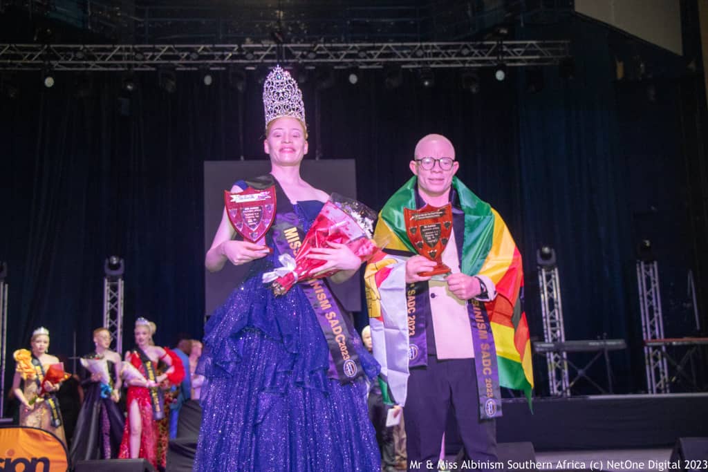 Mr Albinism Southern Africa crowned