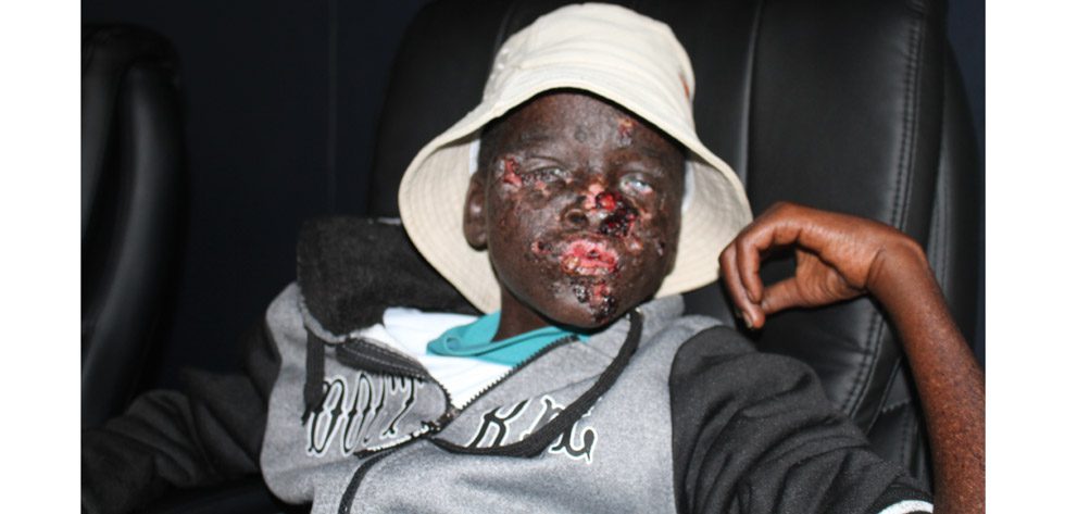 Tonderai Mauchaza has been battling with cancer since he as a toddler