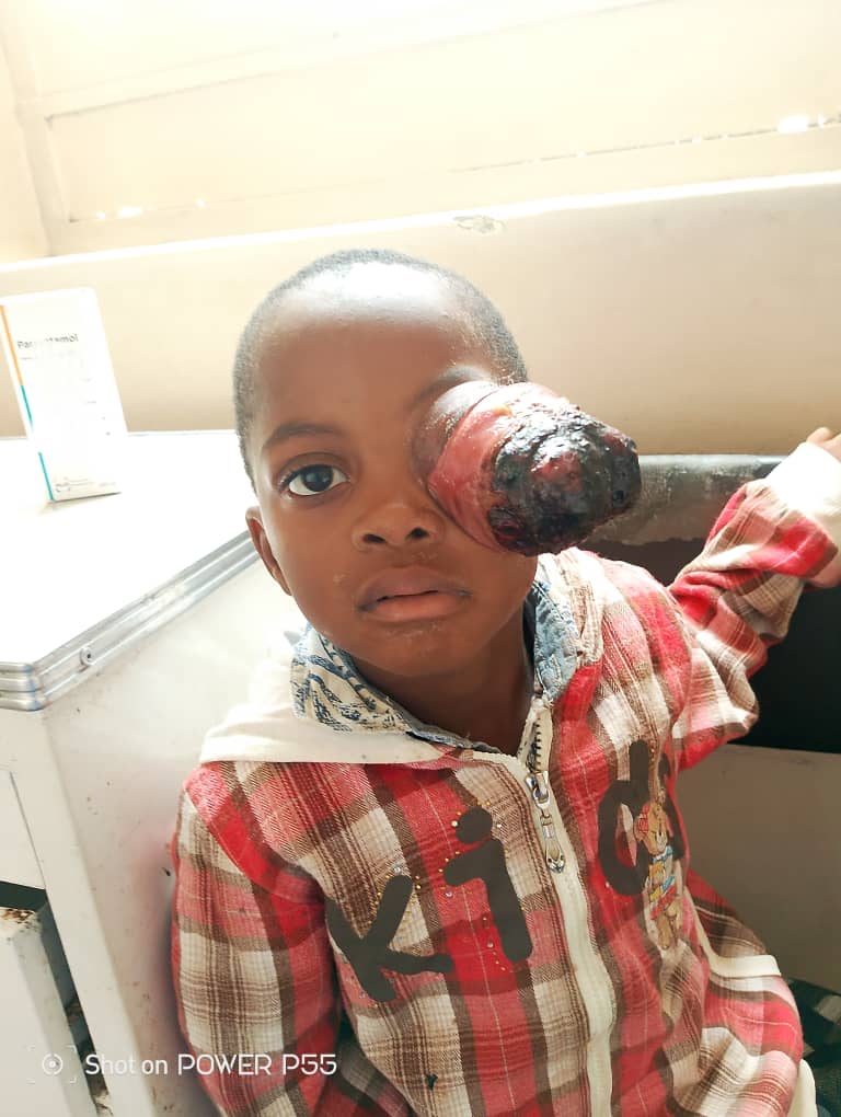 Hwedza boy seeks help