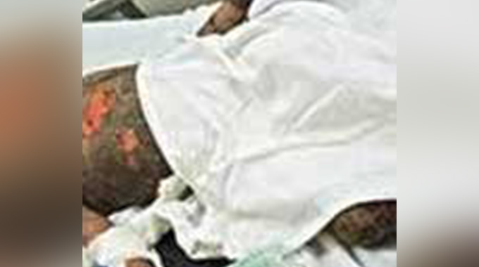 ZESA YAMFRAYA!, Cable thief fried alive during failed Cranborne heist!