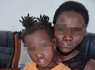 Innscor facilitates cleft lip, palate surgery