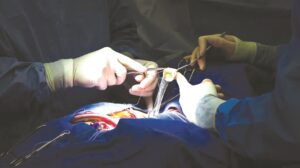 In total, 62 patients have undergone open-heart surgeries at Parirenyatwa Group of Hospitals