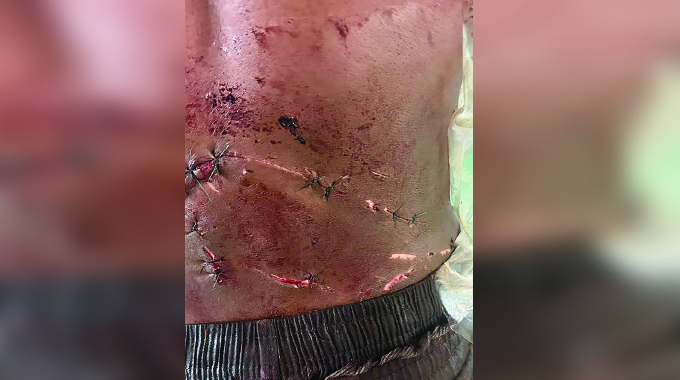 Fists, bottle and machete rampage after being stopped from pestering women. . .Drunk & randy soldier goes berserk