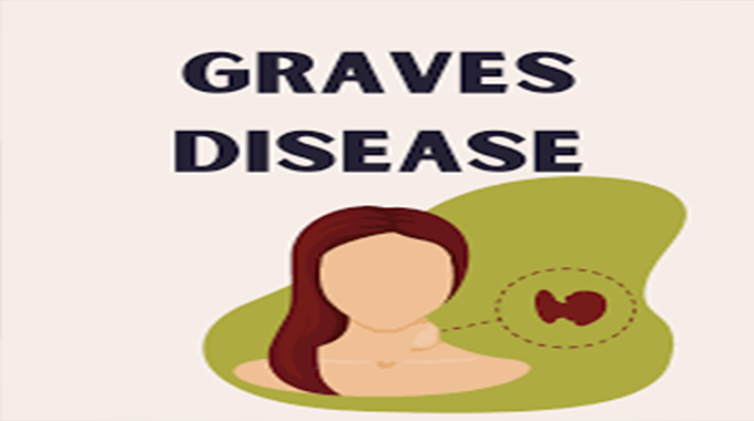 Living with Graves’ disease, a journey of strength and resilience