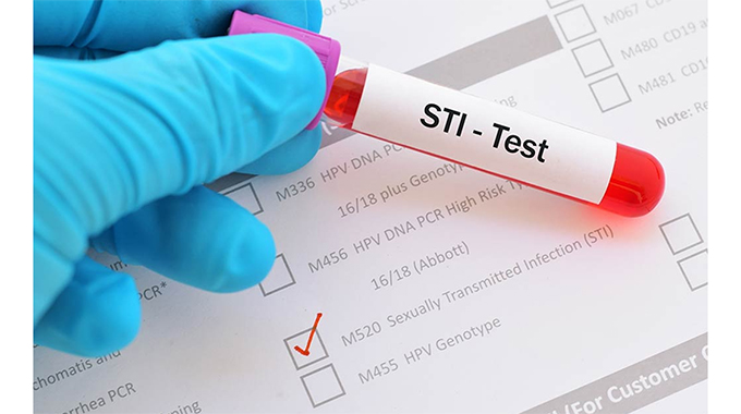 Harare faces surge in STIs