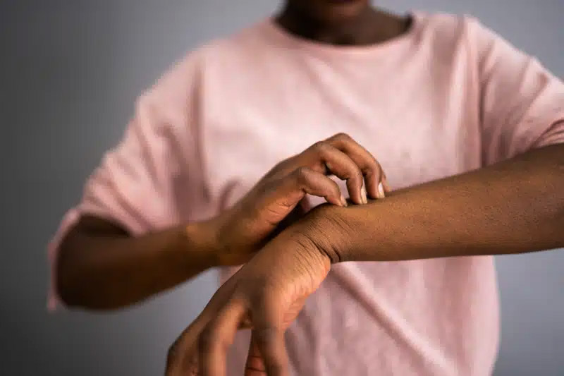Breaking down allergies: What you need to know