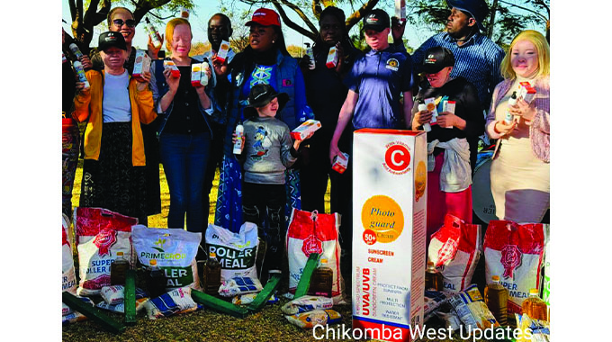 Minister Mavetera castigates stigma against albinism