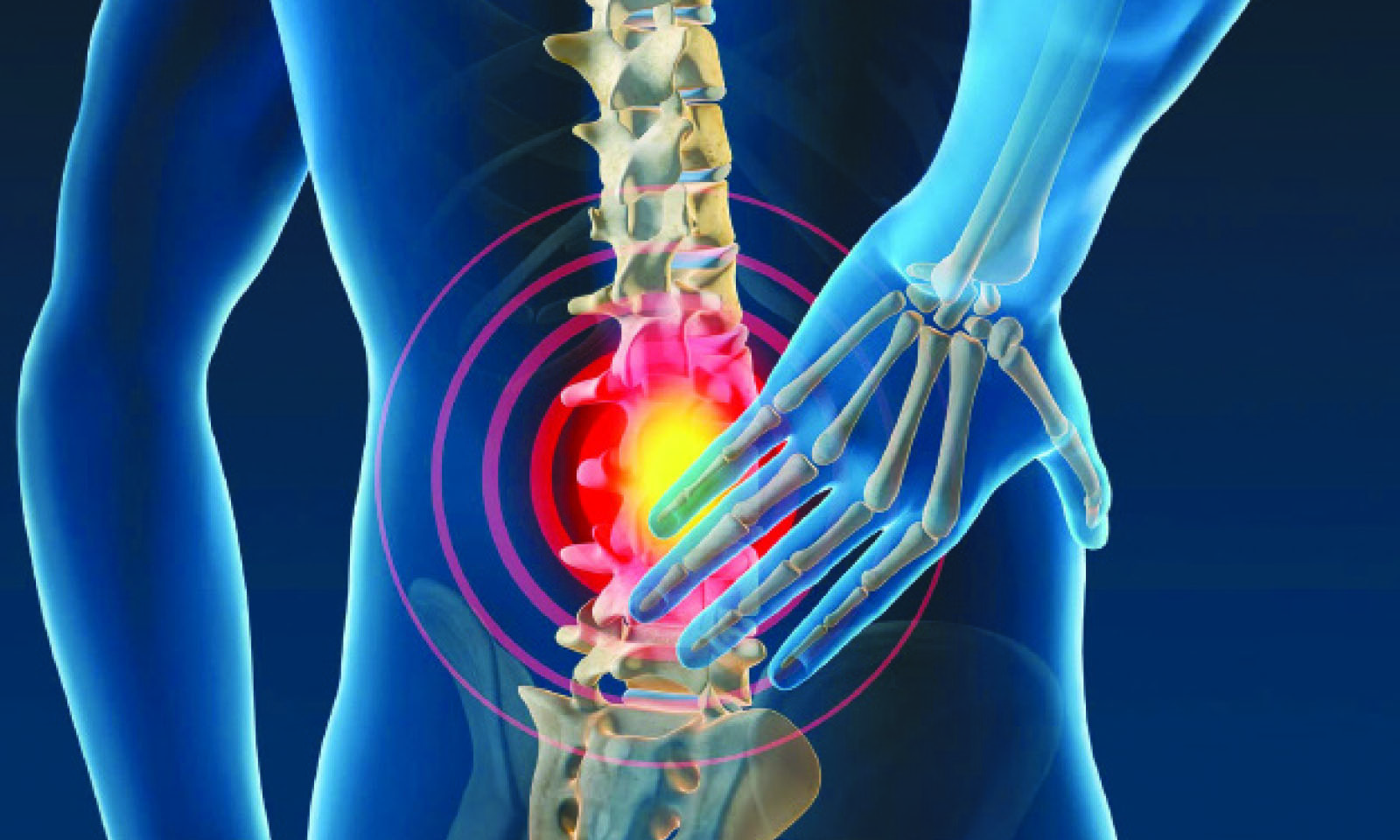 Rising back pain rates signal public health emergency