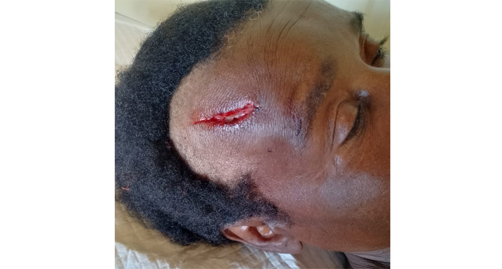Fungai Madongo recovering from the axe attack