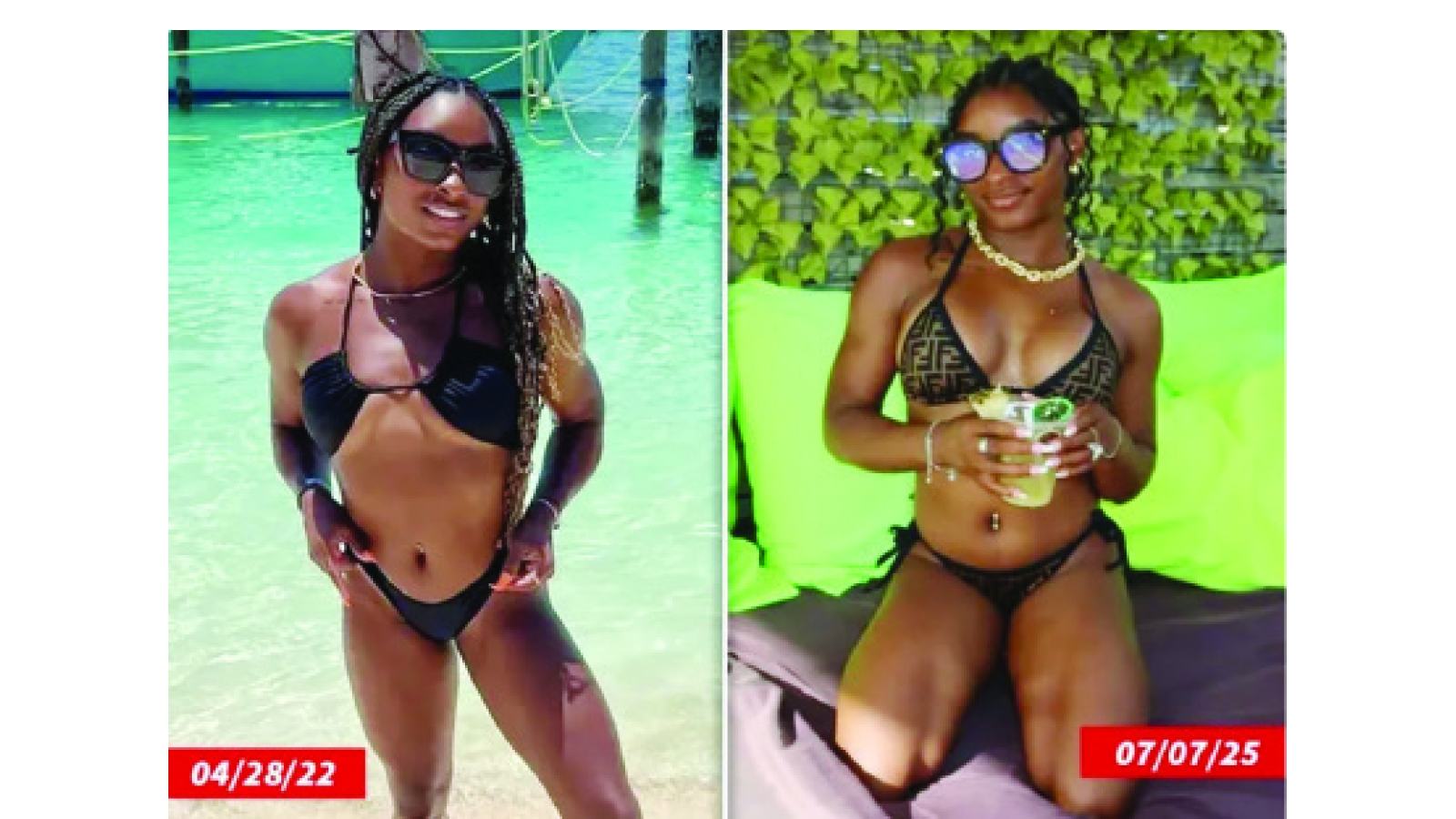 Simone Biles confirms boob job