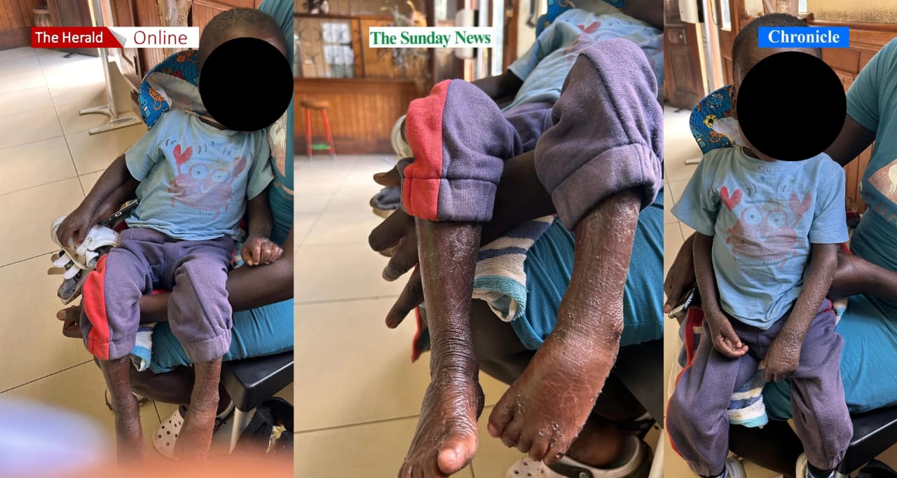 Single mother appeals for help to care for child with rare skin condition