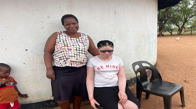 Free eye clinic brings hope to youth with albinism