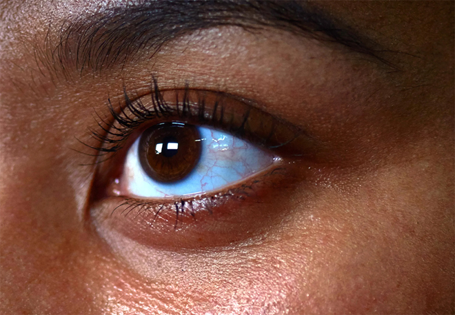 Skin care and lifestyle changes may help reduce the fine lines under your eyes