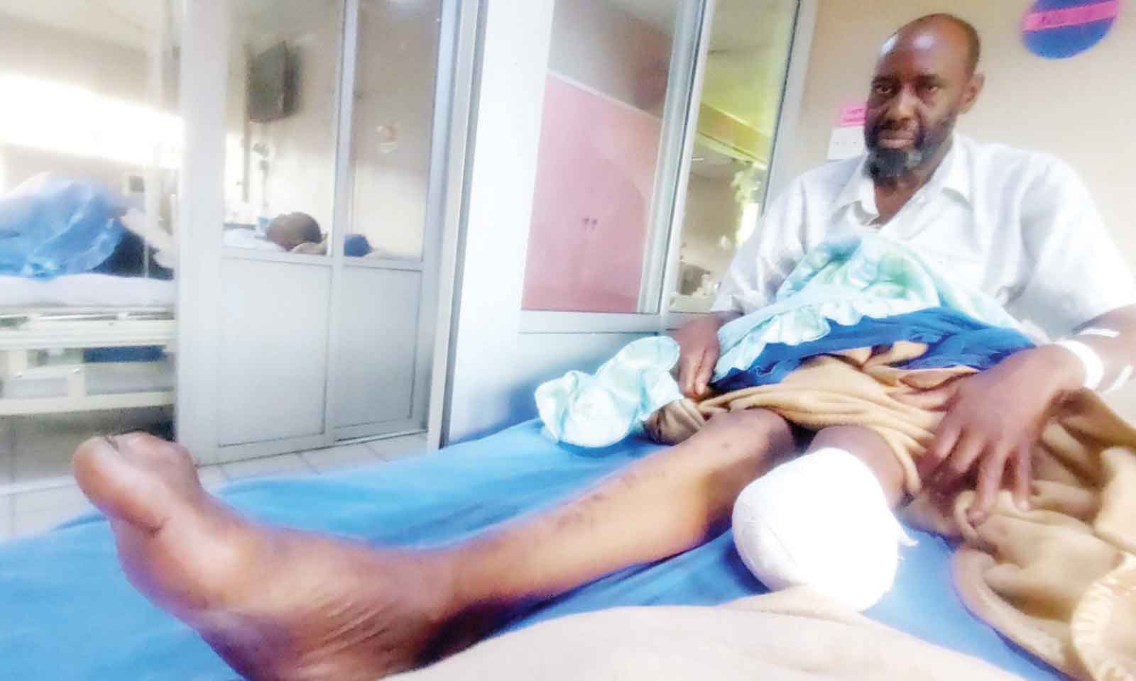 MACHESO’S EX-MANAGER’S LEG AMPUTATED AS HE BATTLES DIABETES