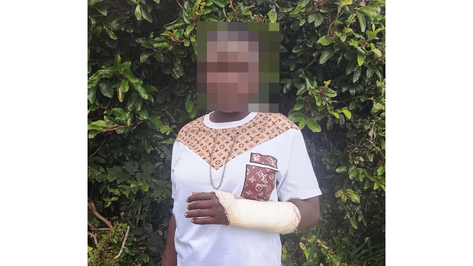 Horomba yegudo yashanyira murwere pamba