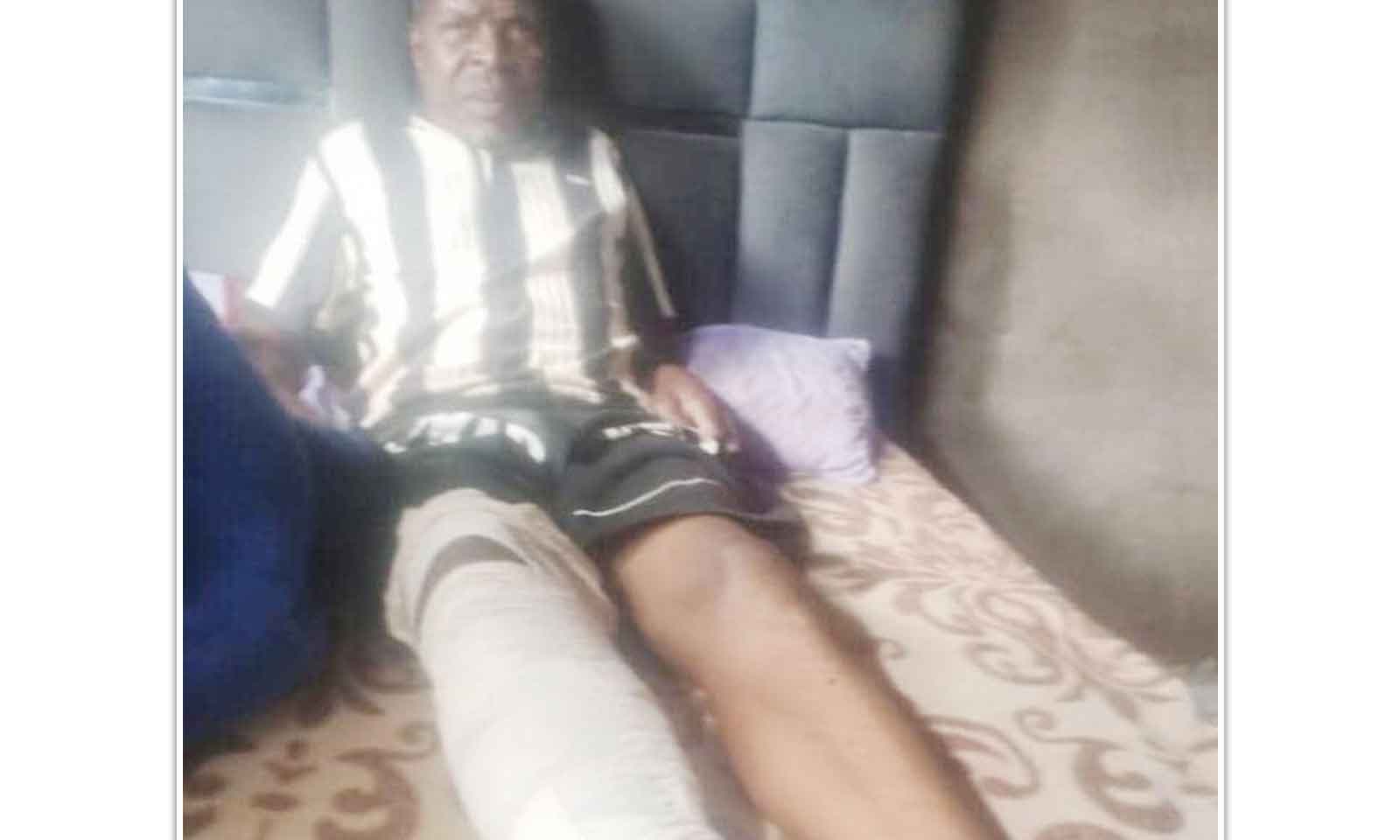 MESI INJURED IN HIT-AND-RUN ACCIDENT