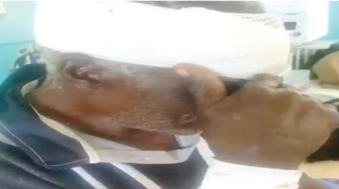 Hyena breaks village head’s arm in daylight attack