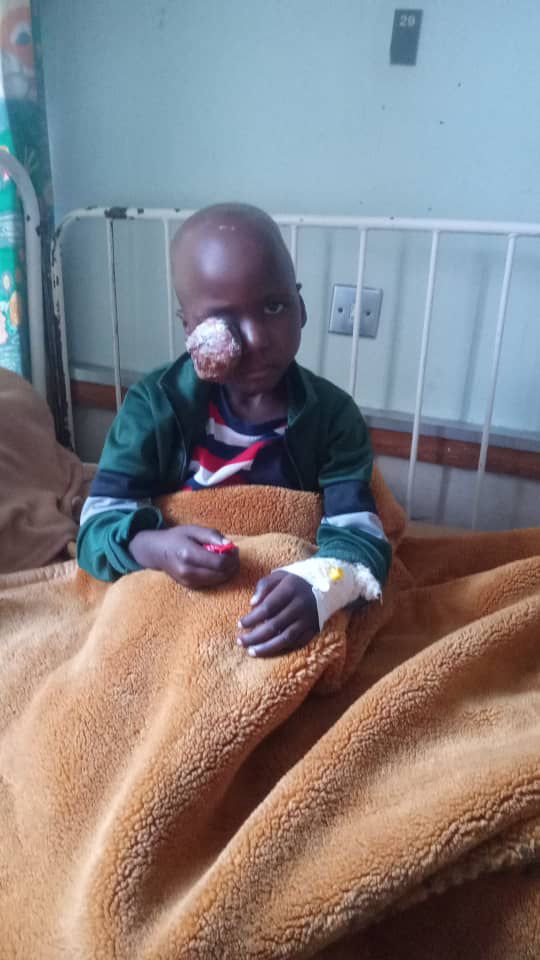 6 year old Nkanyiso Ndlovu from Kezi who suffers from a rare eye Cancer known as Rhabdomyosarcoma.(After Chemotherapy)