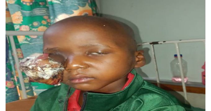 Kezi mother appeals for help as son battles rare eye cancer