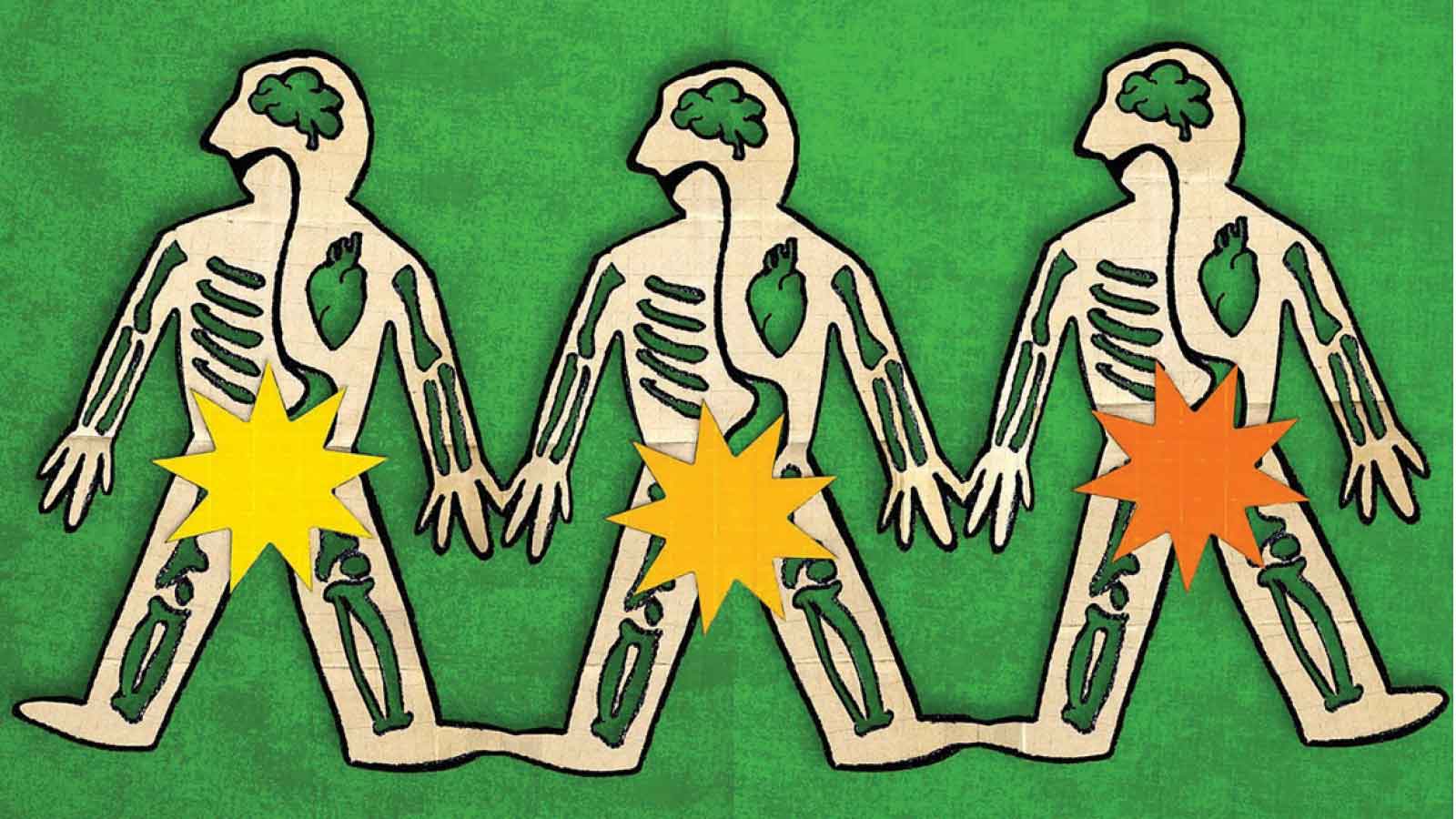 ERECTILE DYSFUNCTION CAN BE AN EARLY WARNING OF A HEART ATTACK, STROKE AND DIABETES