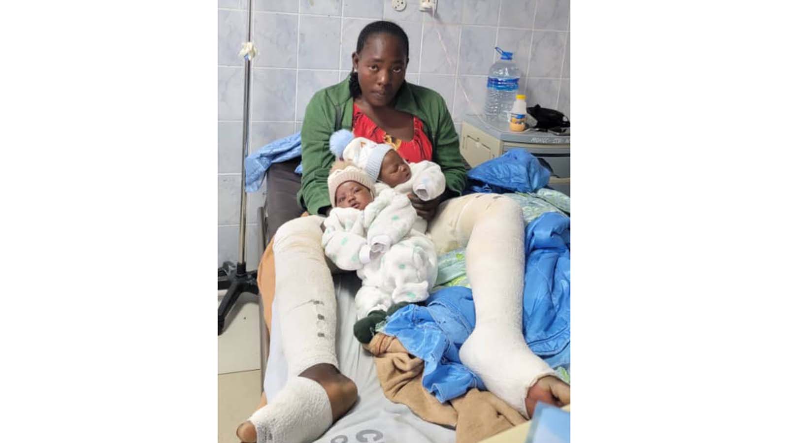 Mudzimai ane mapatya, akatsva nemafuta otsvaga rubatsiro