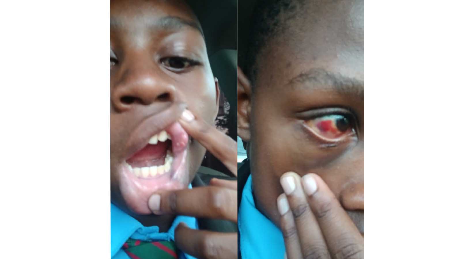 WOMAN FURIOUS WITH RIVERTON ACADEMY OWNER AFTER SON IS BASHED BY ANOTHER STUDENT
