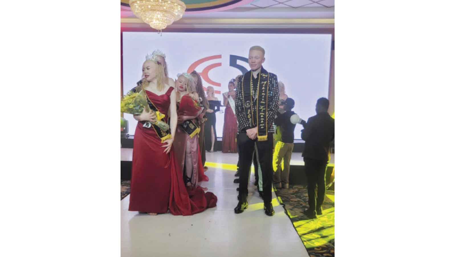 MODEL THABO SIBANDA CROWNED MR ALBINISM ZIM