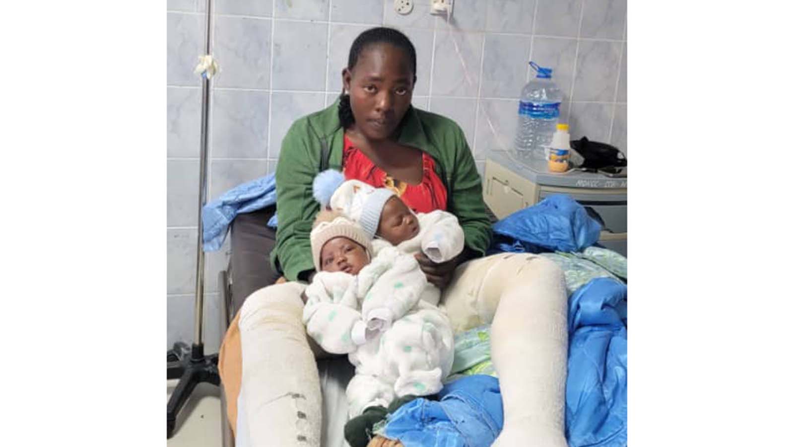 Appeal for assistance as burn victim with infant twins recovers in hospital