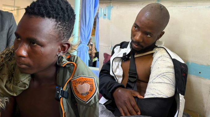 Xenophobia victims recount ordeal . . . as Mpilo assures quality care