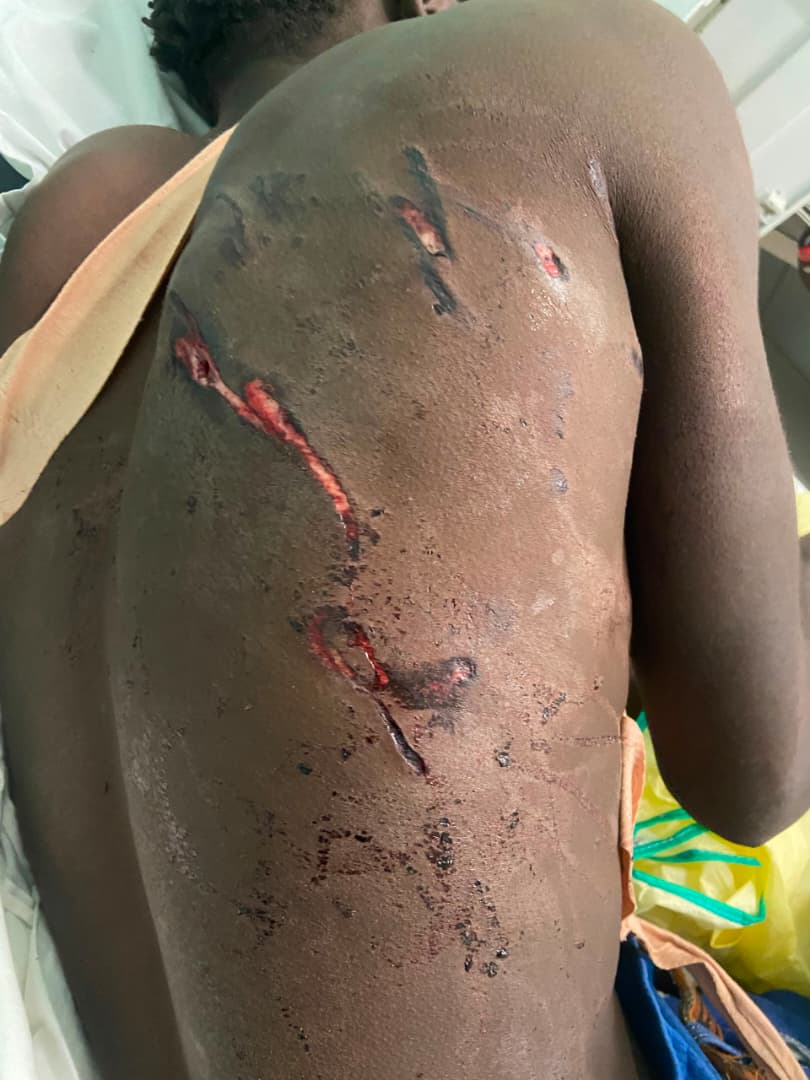 Lion attack survivor recounts harrowing ordeal