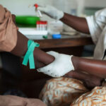 The interaction between HIV and HPV creates a dangerous combination that can accelerate the development of pre-cancerous lesions and cancer