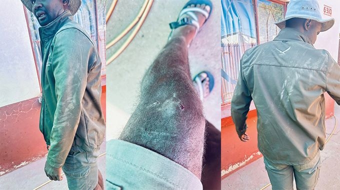 Man survives elephant attack, but the trauma remains
