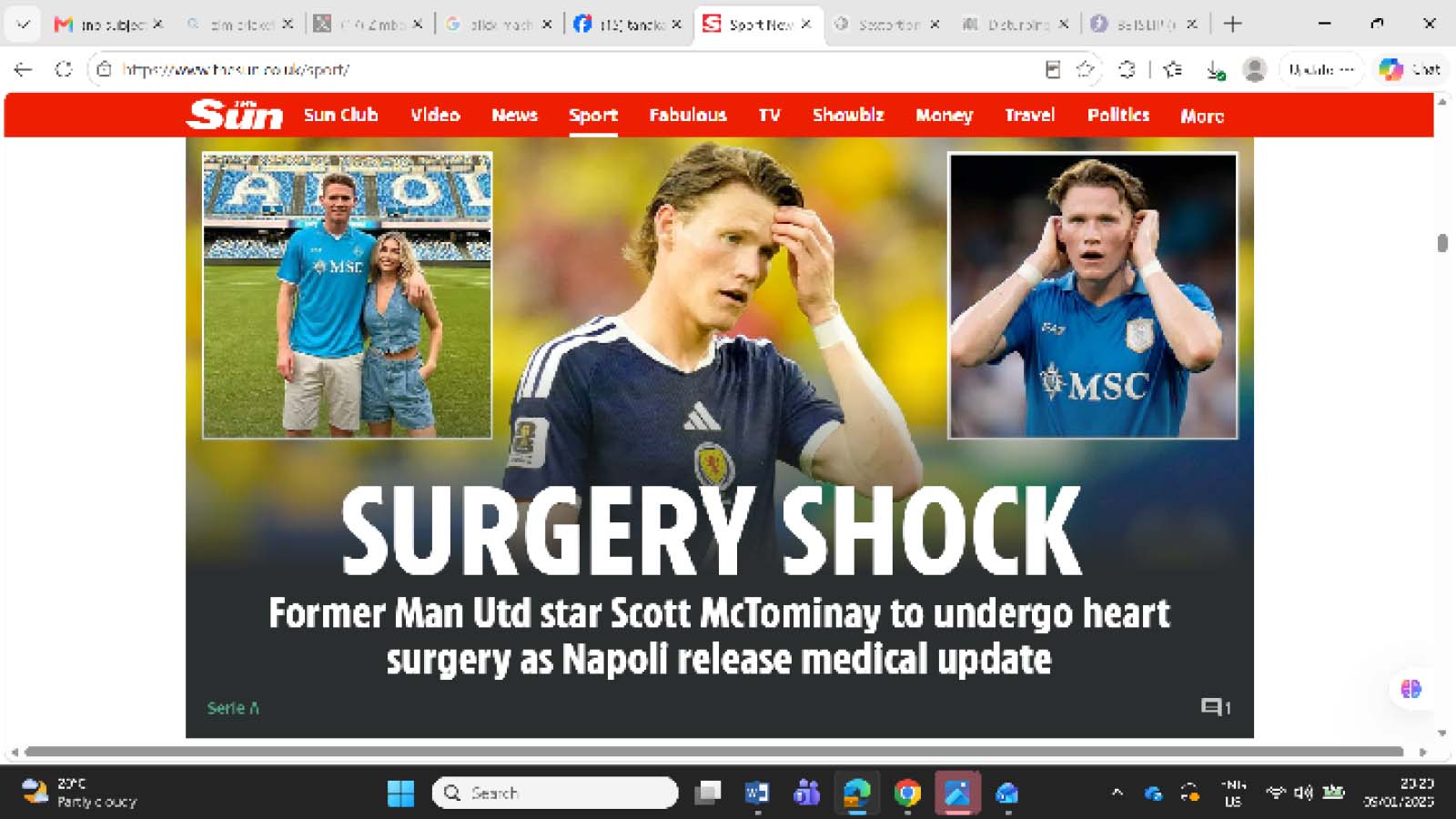 SCOTT MCTOMINAY is set to undergo corrective heart surgery as Napoli announce the star’s mild, benign cardiac arrhythmia.