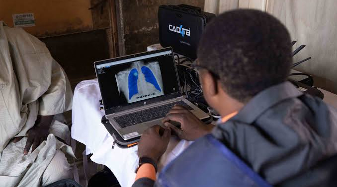 Early TB screening campaign targets high-risk groups