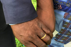 Love defied HIV: Pastor’s inspiring marriage journey