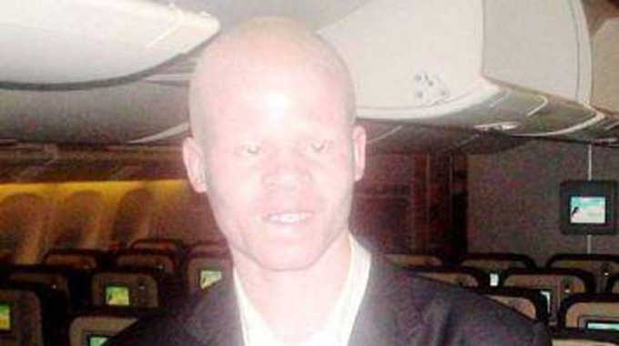 Malawi state broadcaster fires albinism rights activist