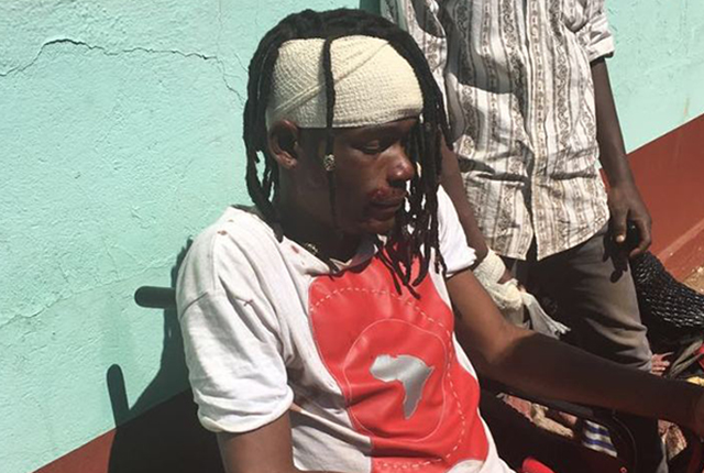Soul Jah Love at Gweru Hospital after the accident yesterday