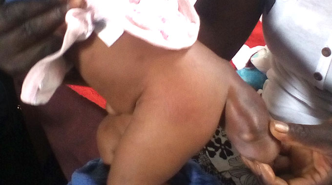 Akabarwa aine unenge muswe