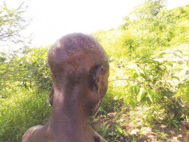 2602-1-1-HIS HEAD WAS ALSO BADLY INJURED FOLLOWING THE ATTACK