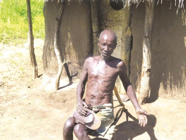 Amos Jokonya, who suffered severe trauma after a buffalo attack, narrates his ordeal (ab0ve), shows his head injuries (top)  and (bottom) goes about his daily duties at his home in Masoka Village, Mbire District