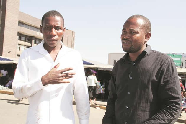 MDC Renewal members Pride Mukono (left) and Makomborero Haruzivishe show the injuries they sustained after an attack by youths allegedly aligned to Mr Elton Mangoma in Harare yesterday