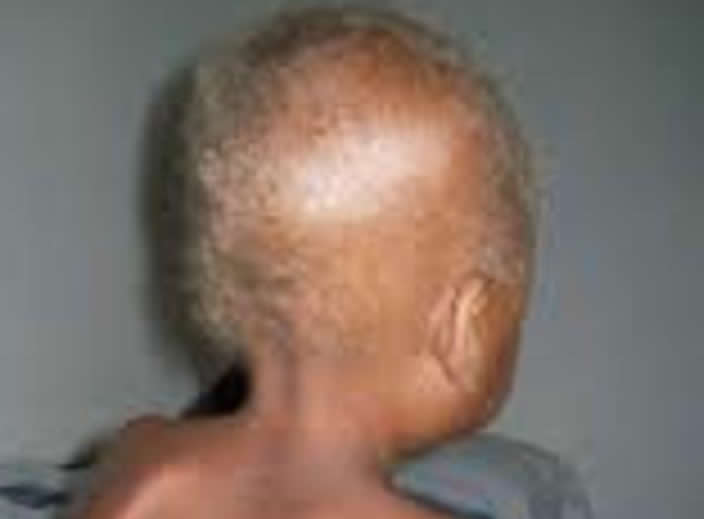 Zviratidzo vemwana ane kwashi
