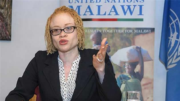 Malawi bans foreign witch doctors over albino murders
