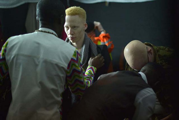 TOPSHOT-KENYA-DISABLED-PEOPLE-HEALTH-ALBINO