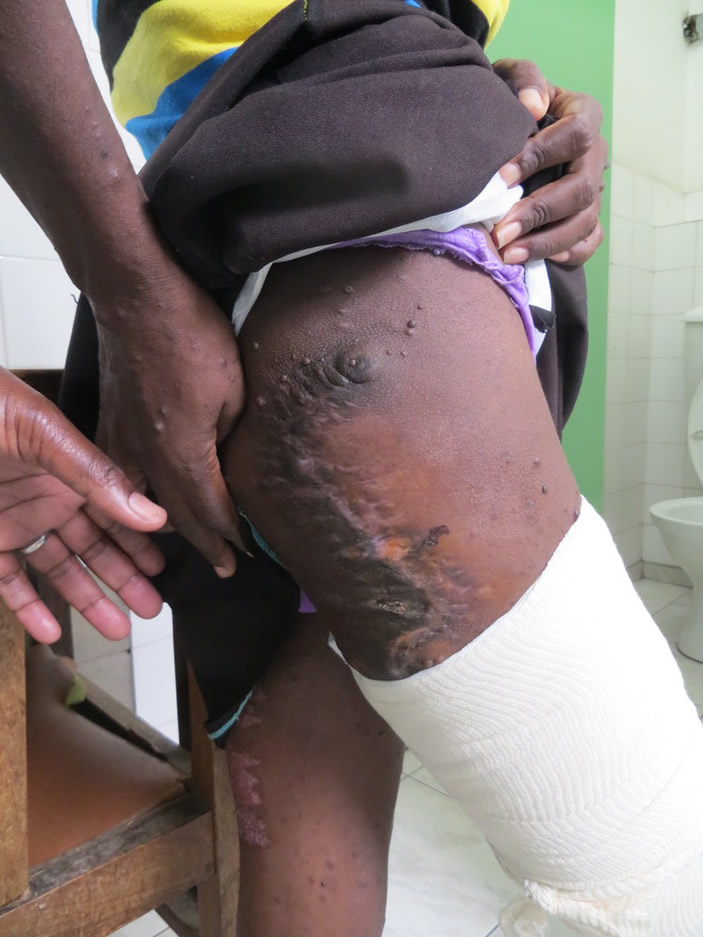 Muringazuva akachekwa zinyama