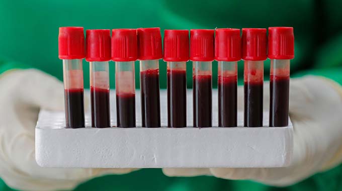 Why do we have different blood types — and do they make us more vulnerable to Covid-19?