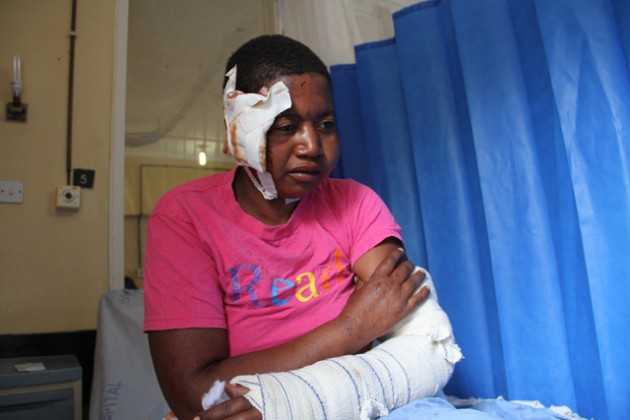 One of the survivors Ms Masline Makanda narrates her ordeal.