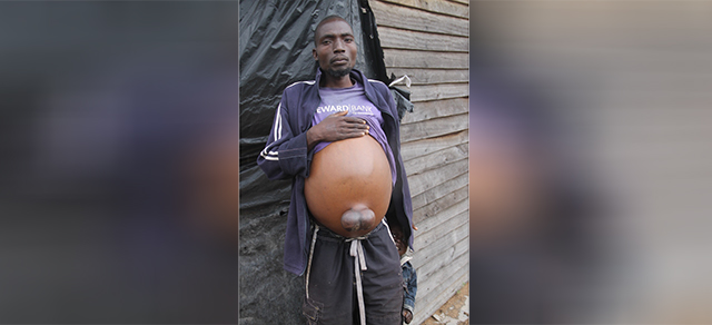 Mukadzi otiza dumbu