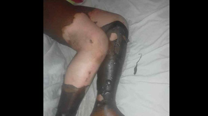 Mwana akagochwa nerufuse
